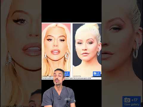 What Is Keto Diet Celebrities Nbt Life