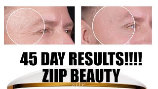 OMG! RESULTS AFTER 45 DAYS OF USING THIS DEVICE... by Wayne Goss 41,175 views 5 months ago 8 minutes, 24 seconds