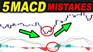 5 MACD Strategy MISTAKES you should avoid in Trading Forex Stocks... or... - Forex Day Trading