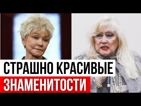 Знаменитости которые СДЕЛАЛИ ПЛАСТИКУ и ЧУТЬ НЕ УМЕРЛИ