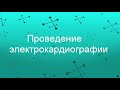 Проведение электрокардиографии