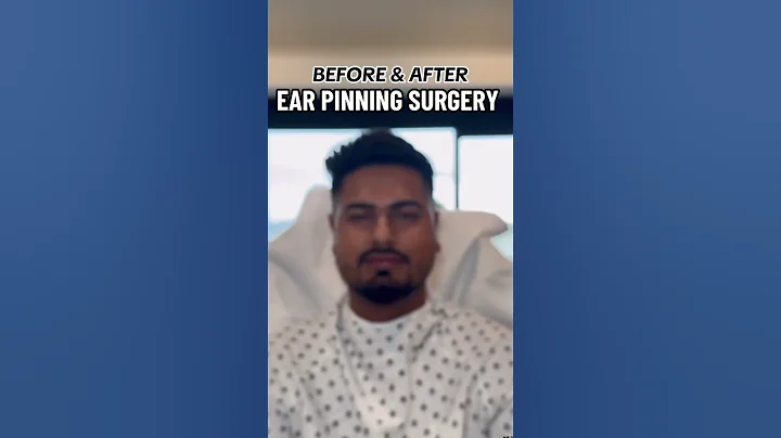 Ear Pinning Surgery RESULTS 🔥 #otoplasty #otoplastia #earpinning