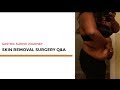 HOW TO GET INSURANCE TO COVER SKIN REMOVAL: GASTRIC SLEEVE JOURNEY PANNICULECTOMY