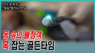 지켜봐도 되는 양성종양🆚 바로 떼야하는 양성종양. 치료의 골든타임을 놓치지않기 위한 방법은?  (KBS 20230531 방송)