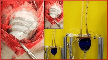 Soft Robot helps the Heart beat | QPT