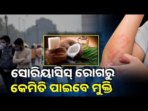 ଶୀତଦିନେ ବ୍ୟାପେ ଏହି ରୋଗ, ରକ୍ଷା ପାଇବାକୁ ଆପଣାନ୍ତୁ ଏହି ଉପାୟ  ||Knews Odisha