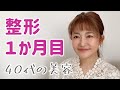 【整形1か月目】経過とご質問におこたえします。
