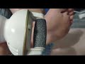 Electric Foot Callus Remover Built in Vacuum Review, Works great, say hello to smooth feet!