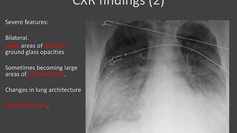 Chest XR and CT in the Coronavirus Pandemic COVID19