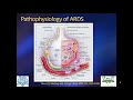 Ventilatory management of ards