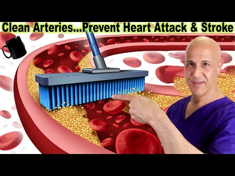 1 Cup Cleans Up Clogged Arteries...Prevent Heart Attack & Stroke | Dr. Mandell