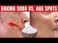 Baking soda permanently remove age skin spots do this