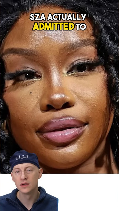SZA New Look | Plastic Surgery Analysis