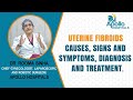 Uterine Fibroids Causes Signs Symptoms Diagnosis Treatment Apollo Hospitals Uterine Fibroids Causes Signs Symptoms Diagnosis Treatment Apollo Hospitals