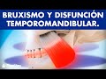 Disfunción temporomandibular y bruxismo ©