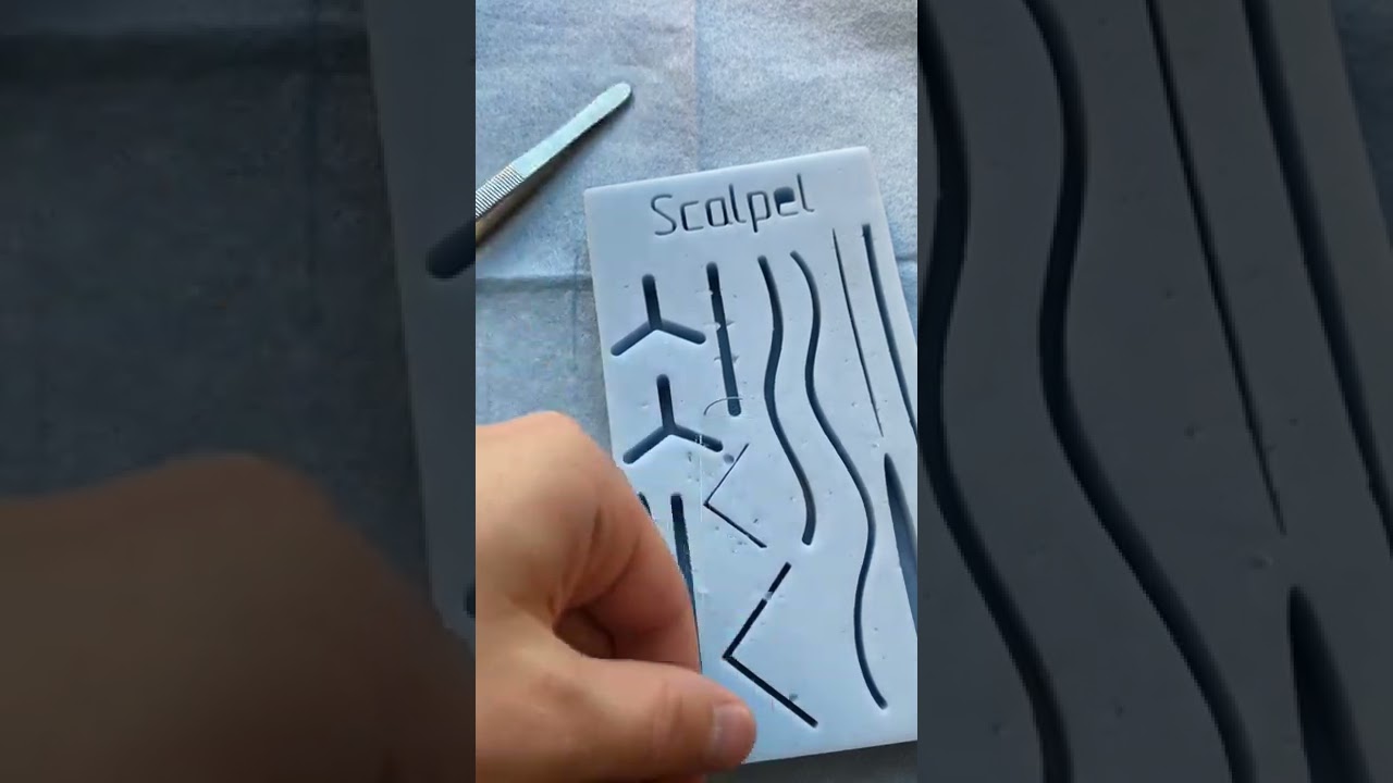 ЧТО ТАКОЕ РАССЛОЕНИЕ АНЕВРИЗМЫ АОРТЫ|SCALPEL.MED