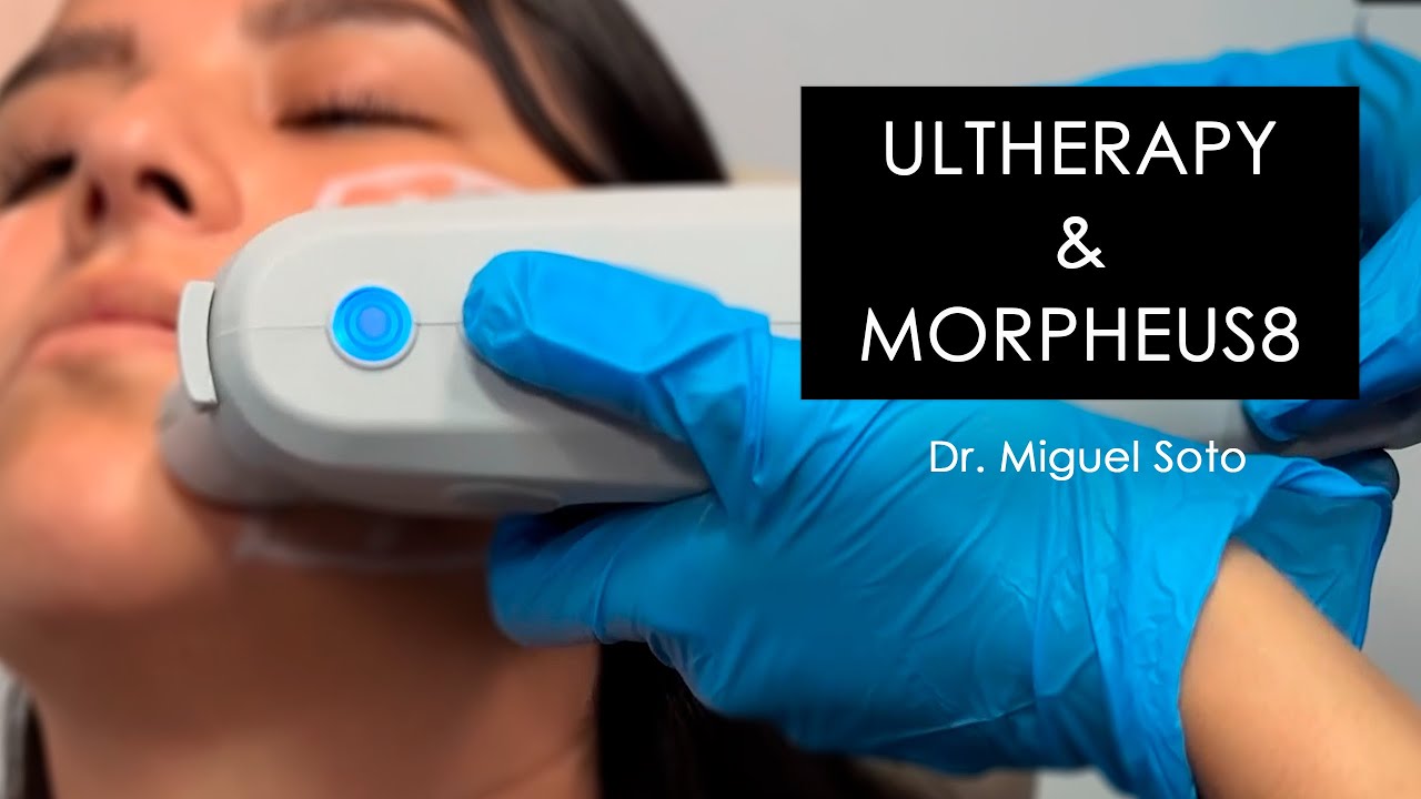 Ultherapy y Morpheus8: Tecnología de energía sin cirugía