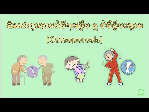 ឱសថព្យាបាលជំងឺពុកឆ្អឹងឬឆ្អឹងស្ពោត (Osteoporosis Pharmacology)