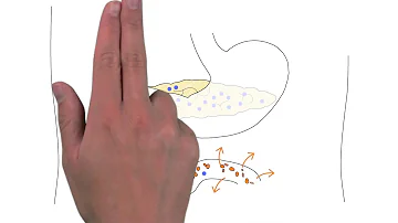 ¿Qué ocurre si no se trata la insuficiencia pancreática?