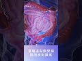 便秘怎麼形成的 腸道健康 黃郁純醫師 便秘 大便 腸道 便秘怎麼形成的 腸道健康 黃郁純醫師 便秘 大便 腸道