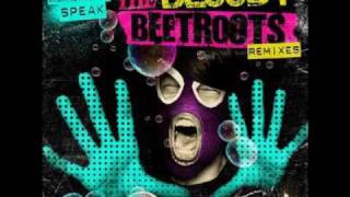 The Bloody Beetroots: I love The Bloody Beetroots