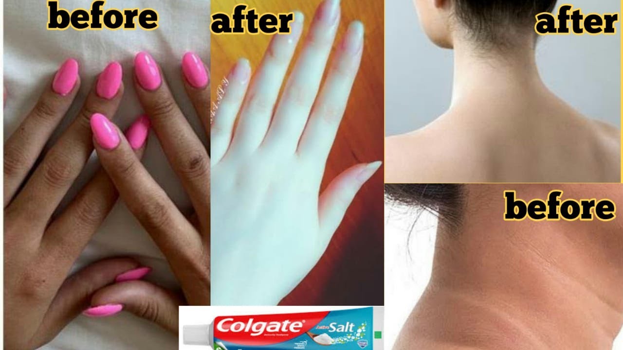 skin whitening colgate toothpaste at home remedies |hand darkness ...