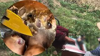 Download Lagu REMOVAL JIGGER | The Fastest Way to Get JIGGER Off Legs | DIRTY FEET #HS217 MP3 Download Lagu REMOVAL JIGGER | The Fastest Way to Get JIGGER Off Legs | DIRTY FEET #HS217 MP3