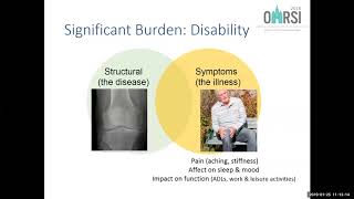 OA is a Serious Disease - Lunch and Learn webinar screenshot 5