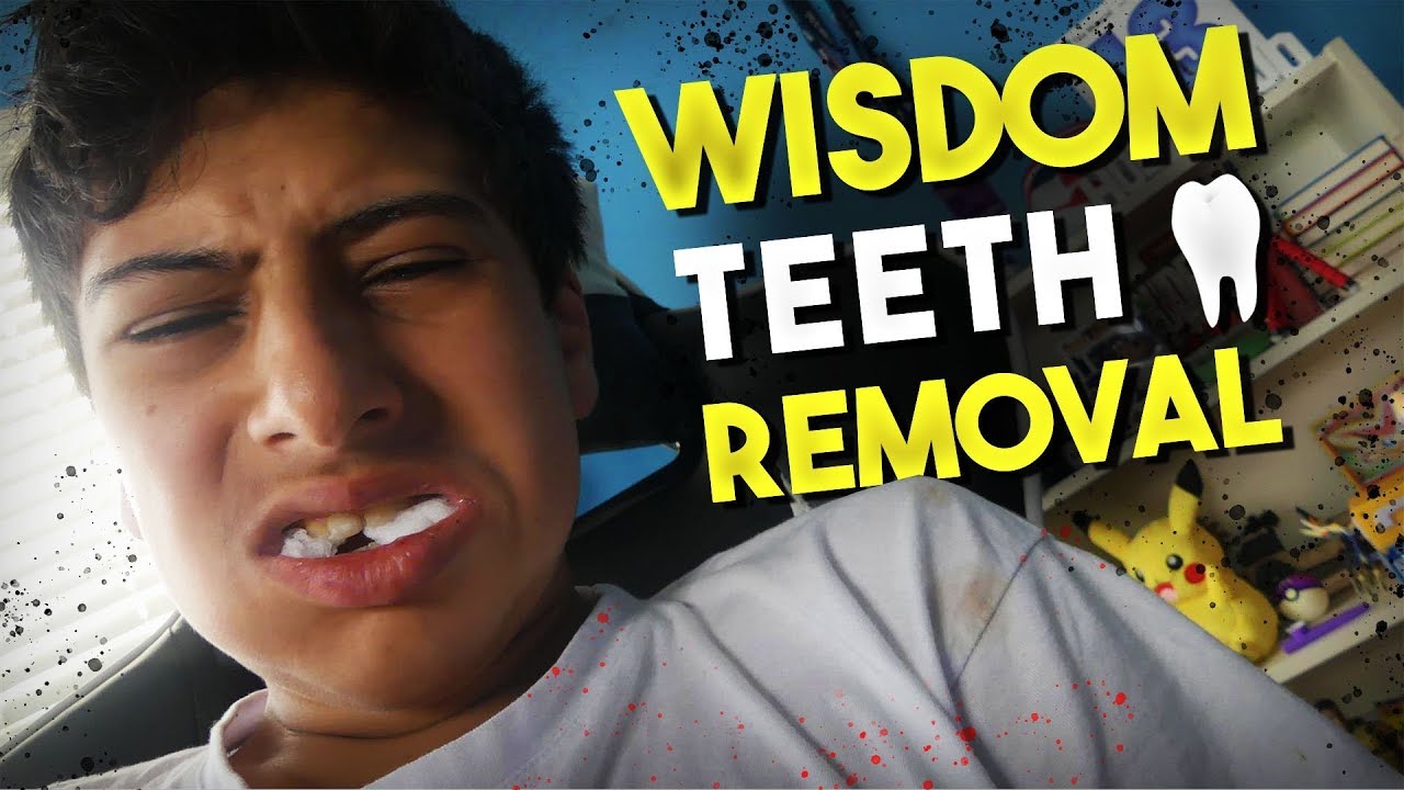 Can 14 Year Olds Get Wisdom Teeth TeethWalls