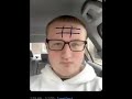 Tic-Tac-Toe On My Forehead