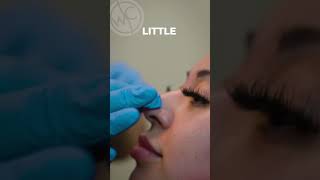 Transform your nose without surgery!