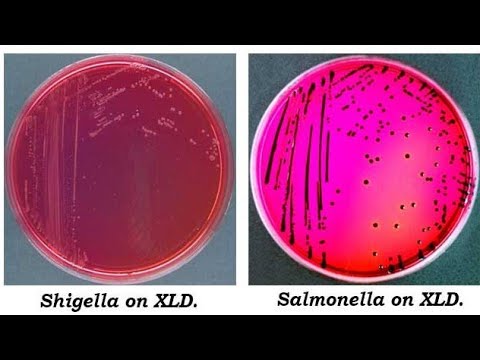 Difference between Salmonella and shigella (Non lactose fermentor enterobacteriaece)