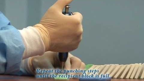 Quick Ray - Tissue microarray