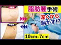 【きずクリ手術動画】脂肪腫切除手術#002 #形成外科 #きずときずあとのクリニック #村松英之