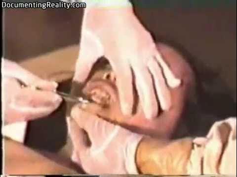 Chinese female autopsy (head to toe examination followed by full evisceration)