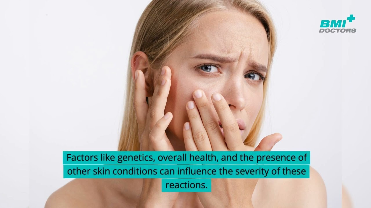 can semaglutide cause skin irritation Acute generalized exanthematous pustulosis sine pustules following semaglutide injection Unlocking the Link: Semaglutide and