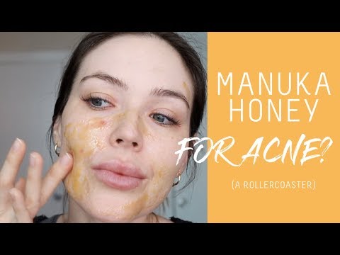 Vídeo: Manuka Honey For Acne: Funciona?