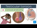 Testicular torsion: causes, symptoms, diagnosis and treatment - Clinical Anatomy | Kenhub