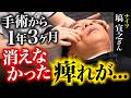 【顔面骨折後の違和感】顔の感覚が事故前に近づいた…衝撃のビフォーアフターにナイツ塙も「泣きそう」