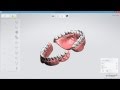 How to create a 3d order in 3shape dental desktop 2015