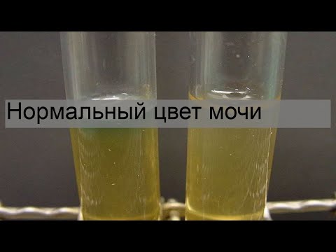 Нормальный цвет мочи