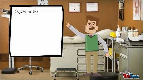 Premature ventricular contractions (PVCs)