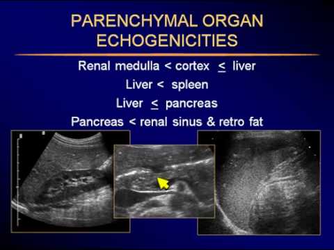 Sonography of the Liver-P1.flv