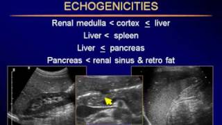 Sonography of the Liver-P1.flv