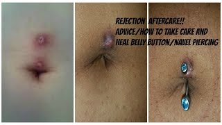 REJECTED BELLY BUTTON PIERCING! My experience & Advice on it