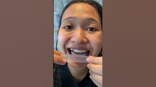 Rahsia putihkan gigi Siti