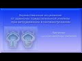 От аденомы . Программа для подсознательных сообщений. (Сытин)