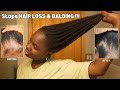 Use this once a week and your hair will never stop growing diy for hair loss  balding