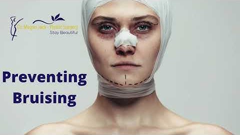 SECRET tip to preventing bruising and swelling with fillers and surgery