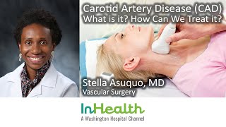 Carotid Artery Disease (CAD): What Is It? How Can We Treat It?